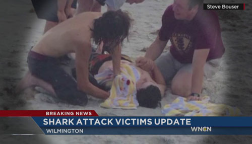 Boy Who Lost Arm In Shark Attack In Good Condition, Surgeon Says (Image 1)_9403
