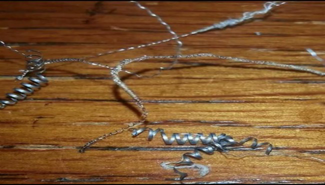 Essure_93772