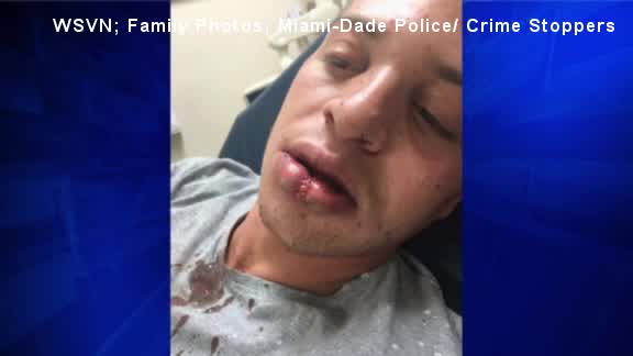 Florida tourist claims he was assaulted for being gay_109039