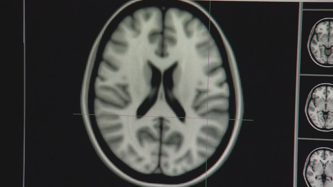 brain_110102