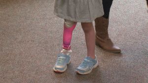 prosthesis00000000_114051