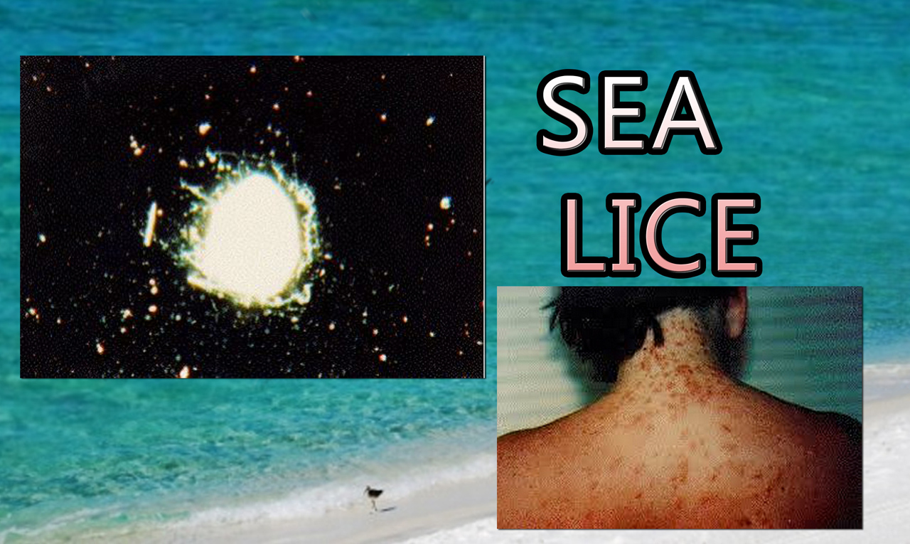 sea lice social_134192