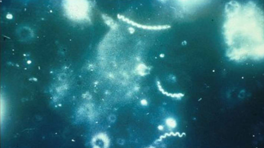 syphilis_134895