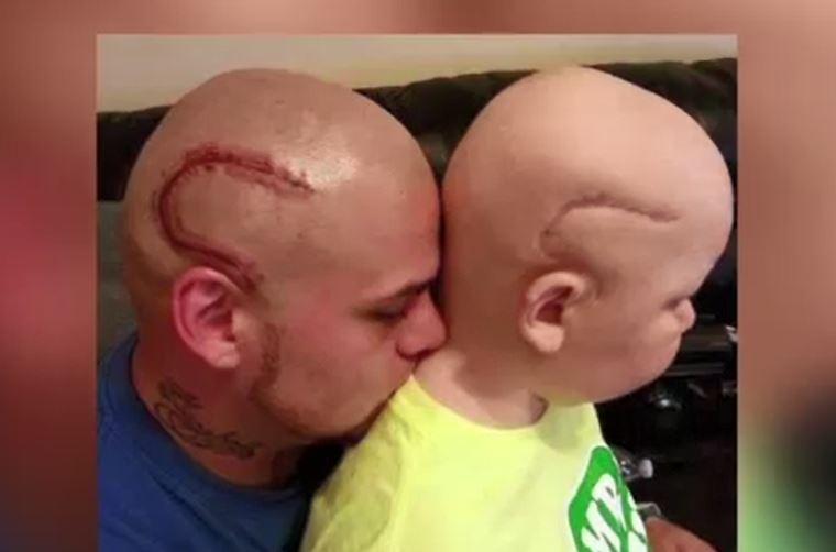 tattoo1 father son cancer scar_141233