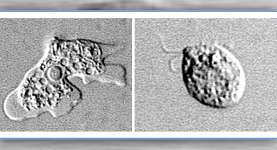brain-eating amoeba_140476