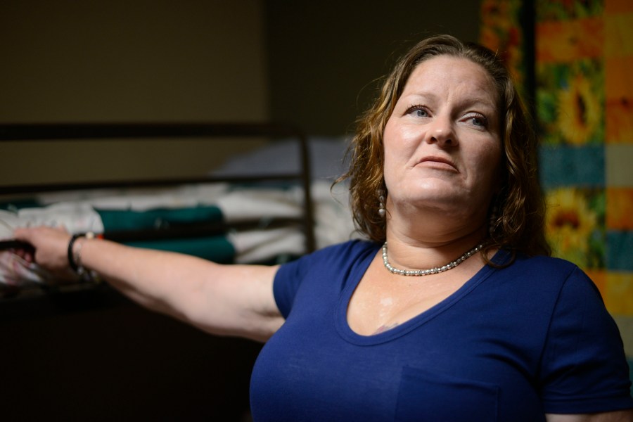 Brain Injuries Domestic Violence_174557