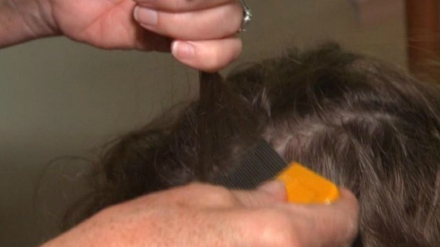 generic-checking-for-lice_174692