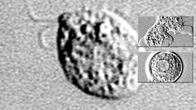 naegleria-fowleri-cdc-0825_167444