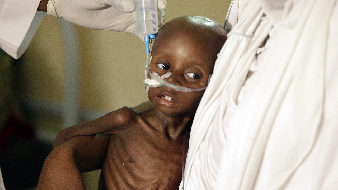 Nigeria Boko Haram Starvation_180997