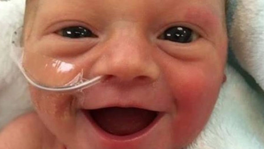 smiling-preemie-web_bkg__197794