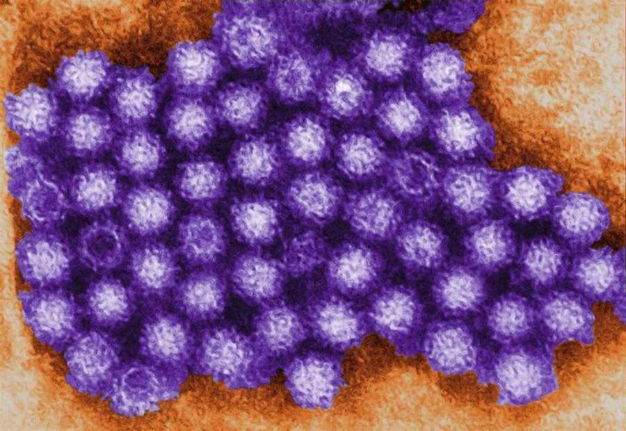 140602-norovirus-jms-2029_16e4b0f2640ac5a92befeafde7bd3591-nbcnews-ux-2880-1000_217781