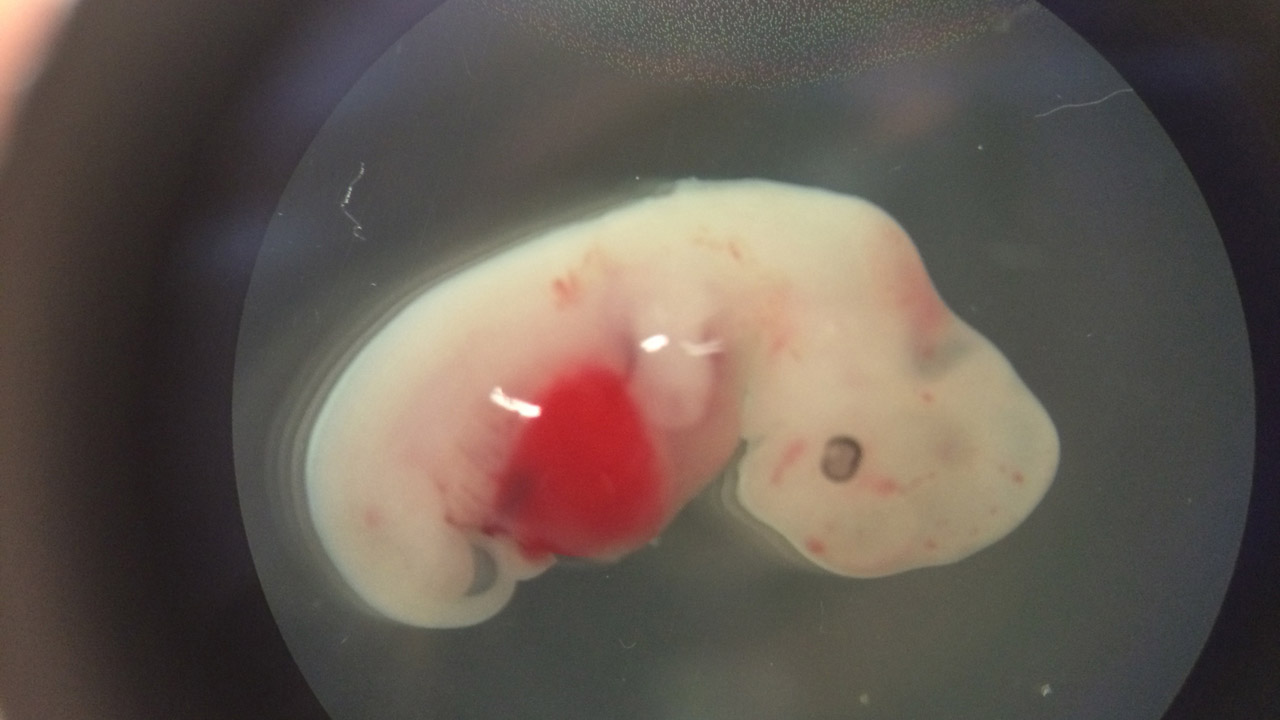 human-pig-embryo_236955