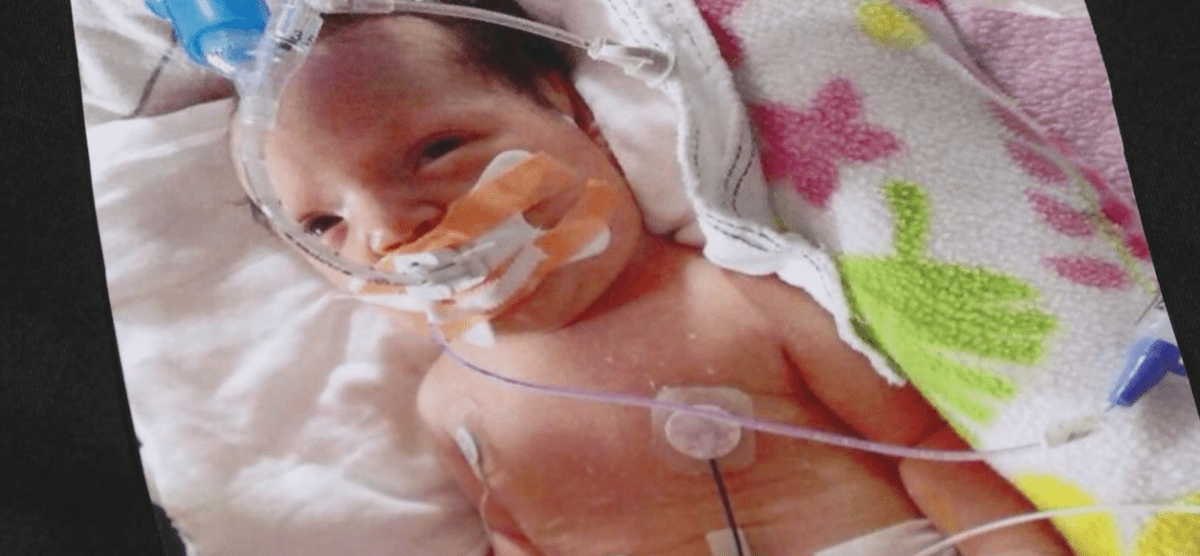 baby-makes-remarkable-recovery_240799