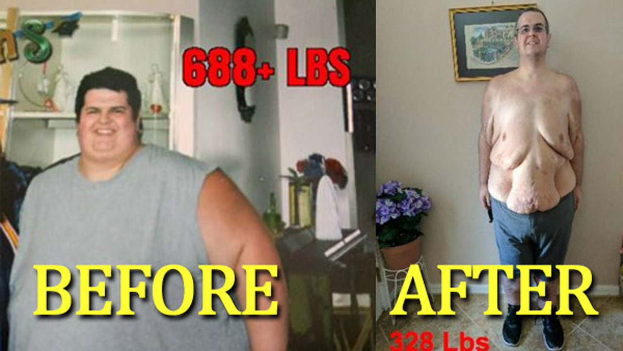 weight-loss-story_263164