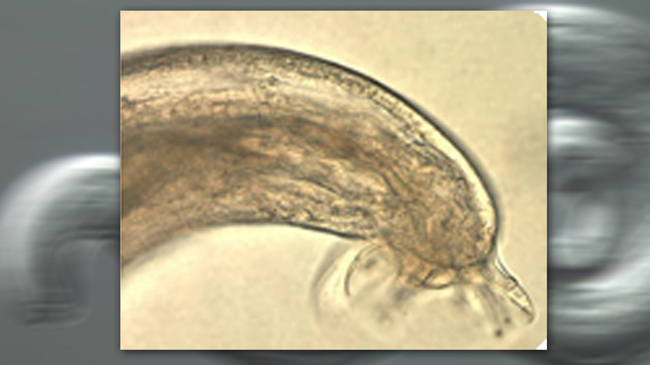 rat-lungworm-disease_284377