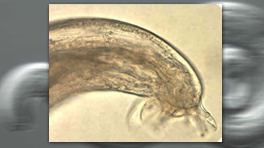 rat-lungworm-disease_284377