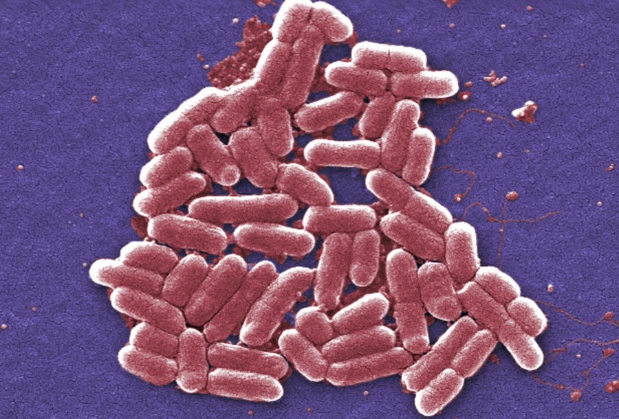SEPSIS_307909