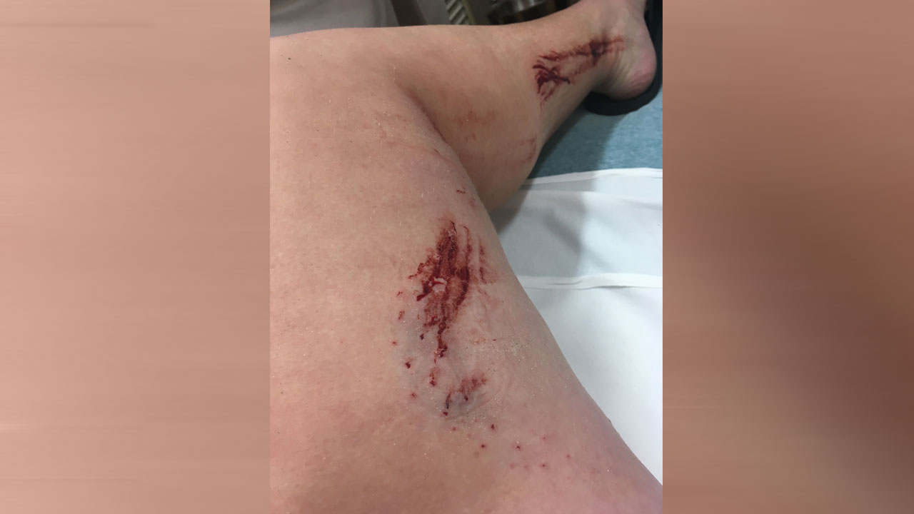 SHARK-BITE_329374