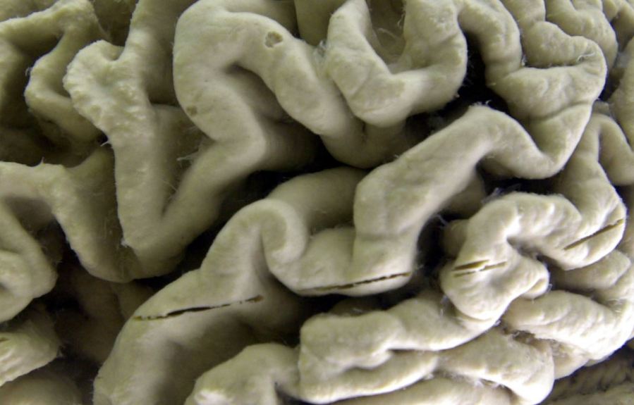 brain_337953