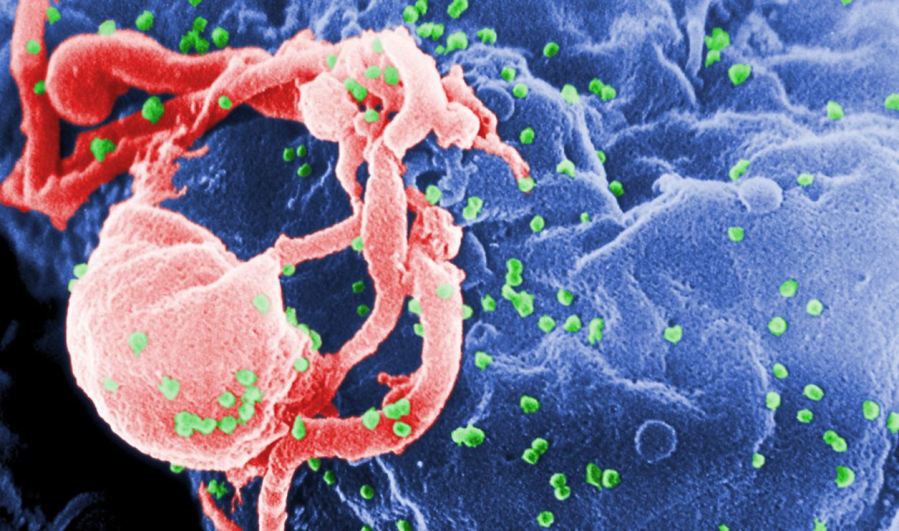 hiv_338765