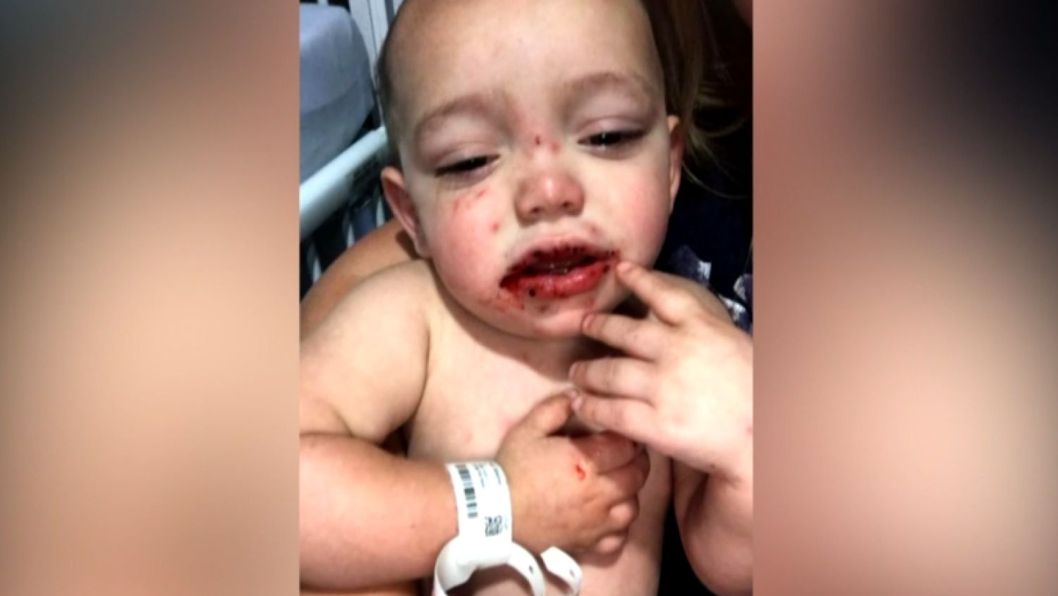 NC_herpesbaby0731_1500x845_340695