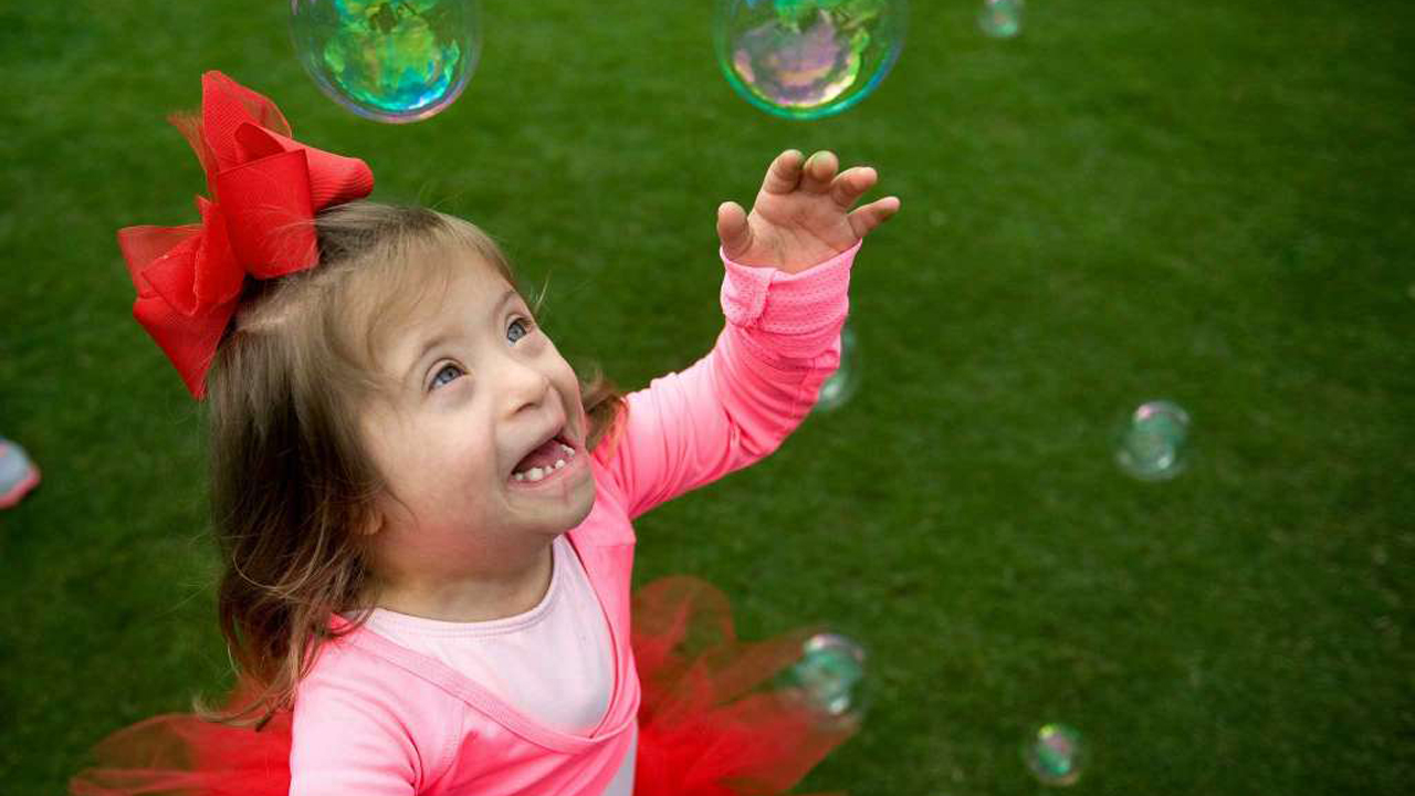down syndrome kid_345932