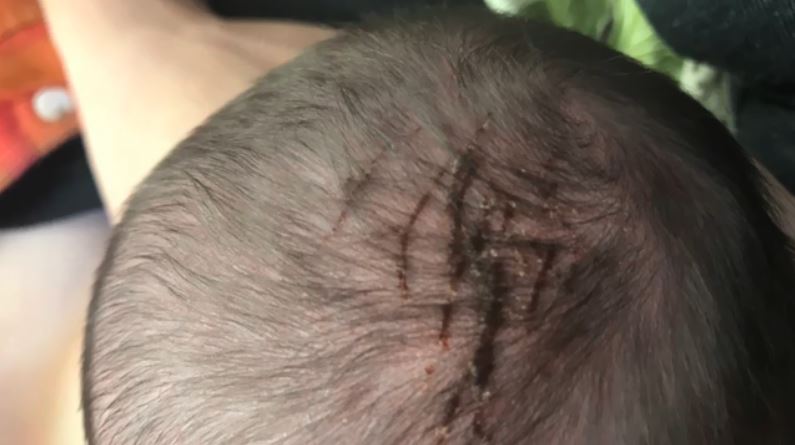 babyinjured_384866