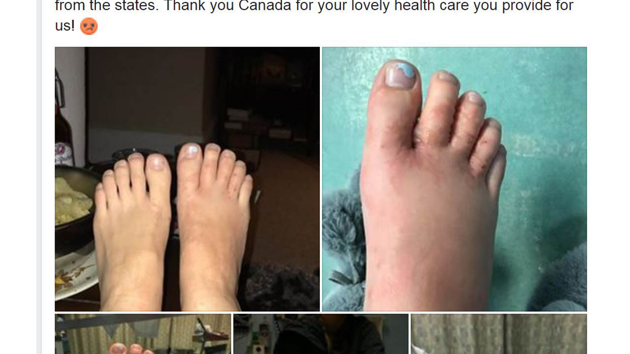 hookworm_384453