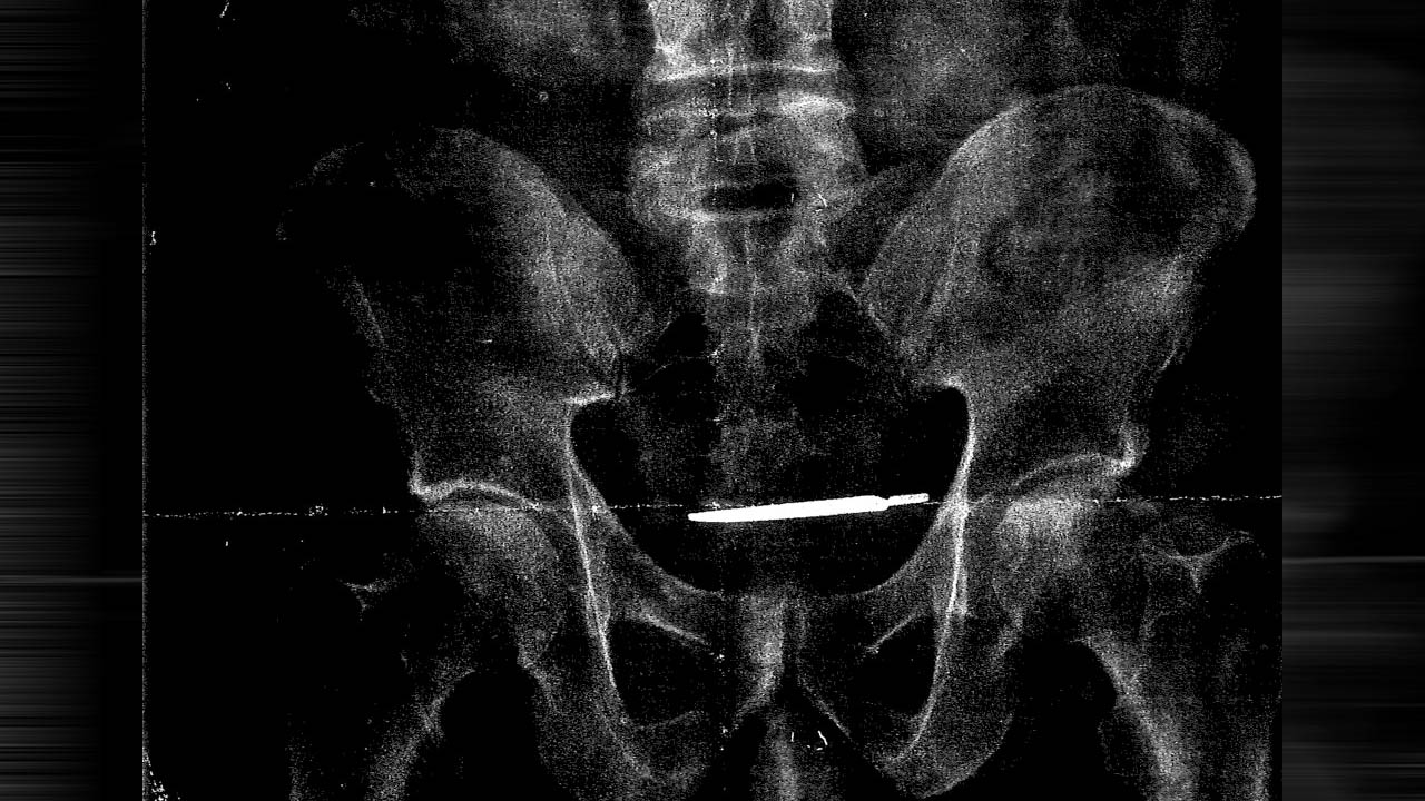scalpel_380244