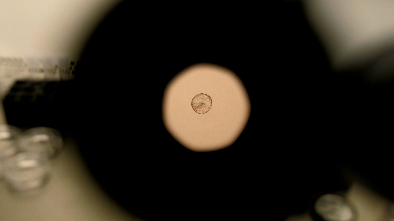 embryo_400429