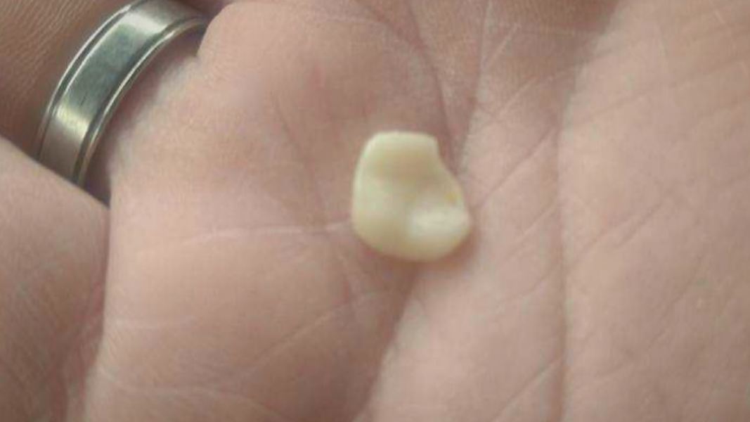 tooth_403580