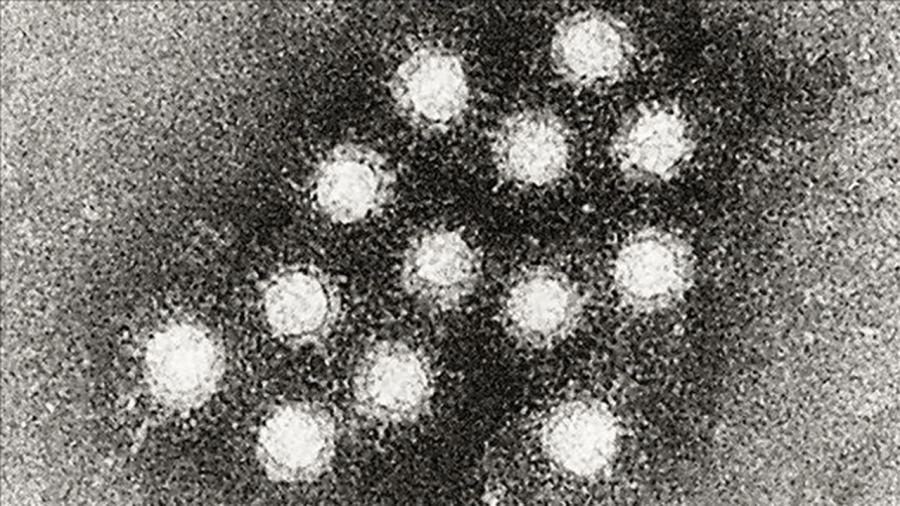 hepatitis a under microscope_1529704529576.png.jpg