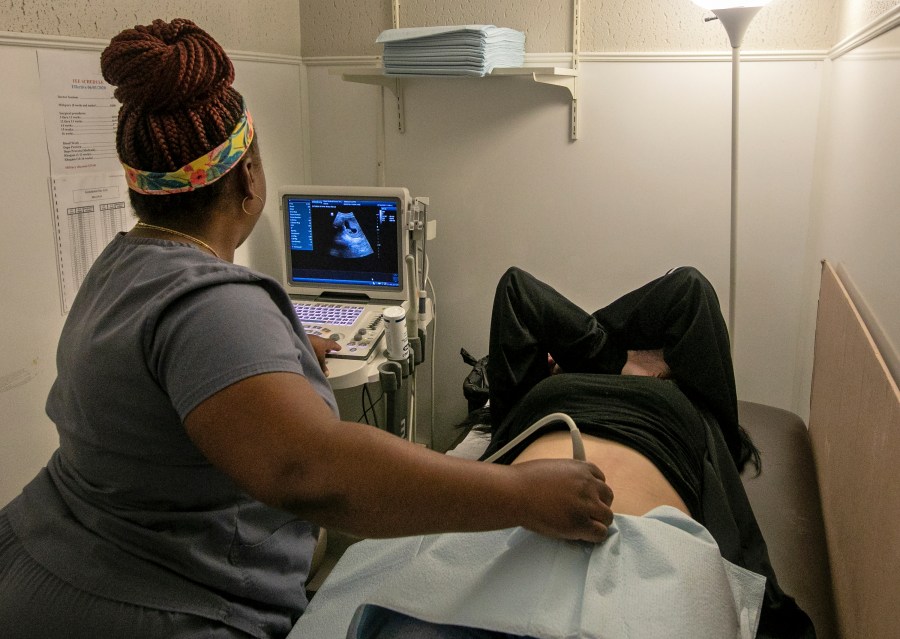 FILE - An operating room technician performs an ultrasound on a patient at Hope Medical Group for Women in Shreveport, La., on July 6, 2022. Doctors in states with strict abortion restrictions say an increasing number of pregnant women are seeking early prenatal testing, hoping to detect serious problems while they still have time to choose whether to continue the pregnancy. (AP Photo/Ted Jackson, File)